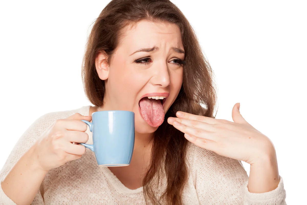 Burned tongue