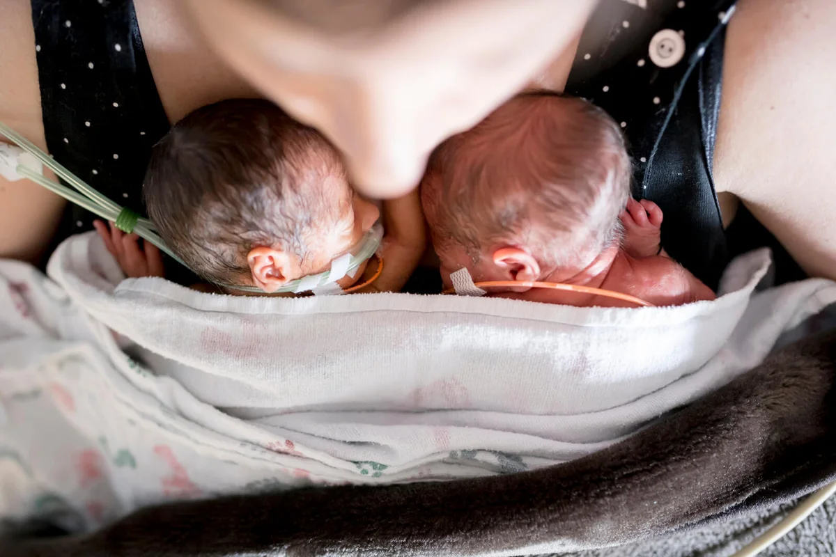 Premature babies are held by mother for the first time