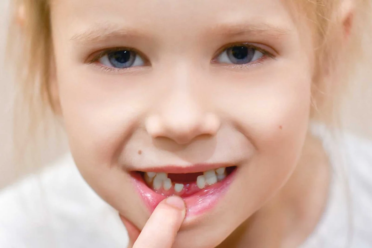 young girl loosing first tooth