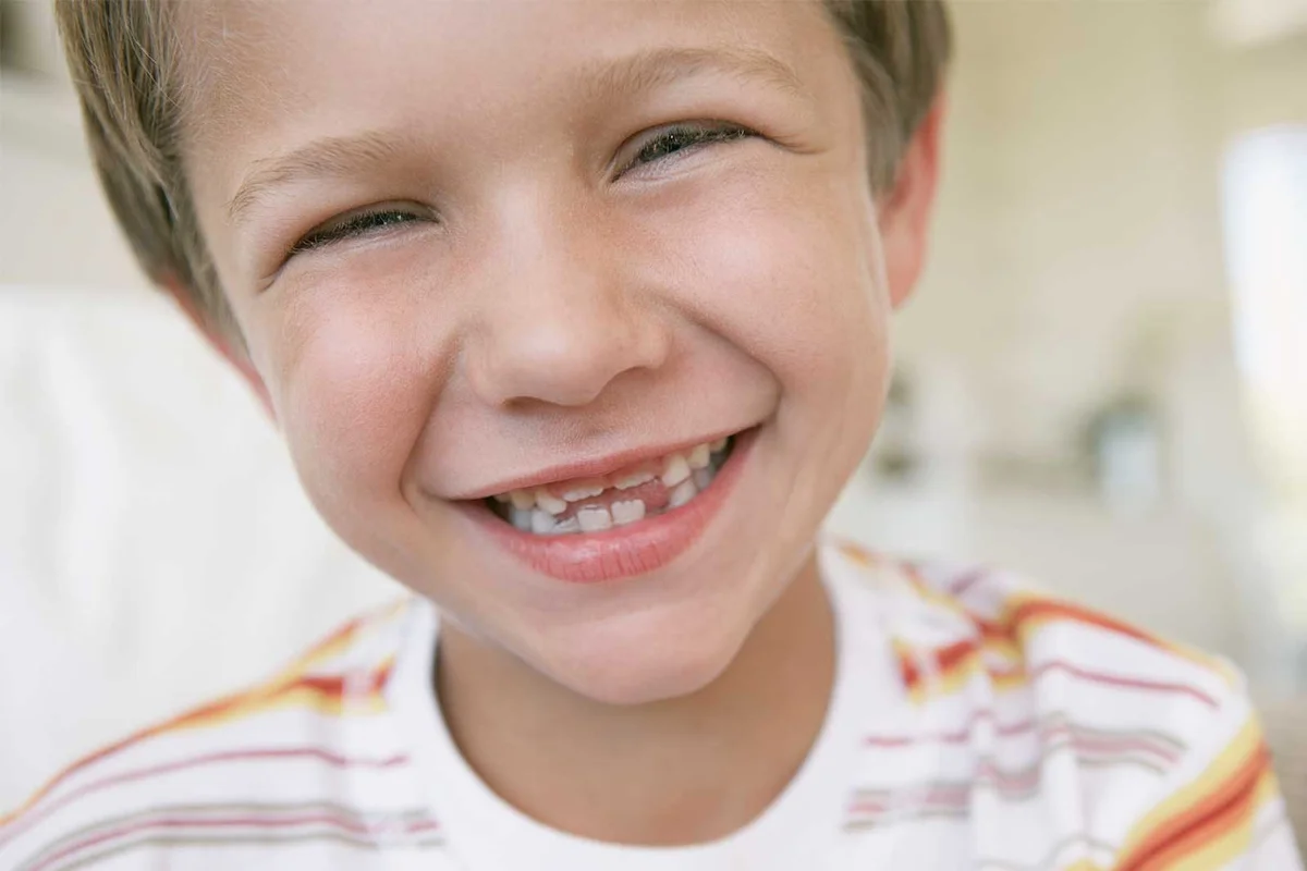 smiling boy with missing teeth