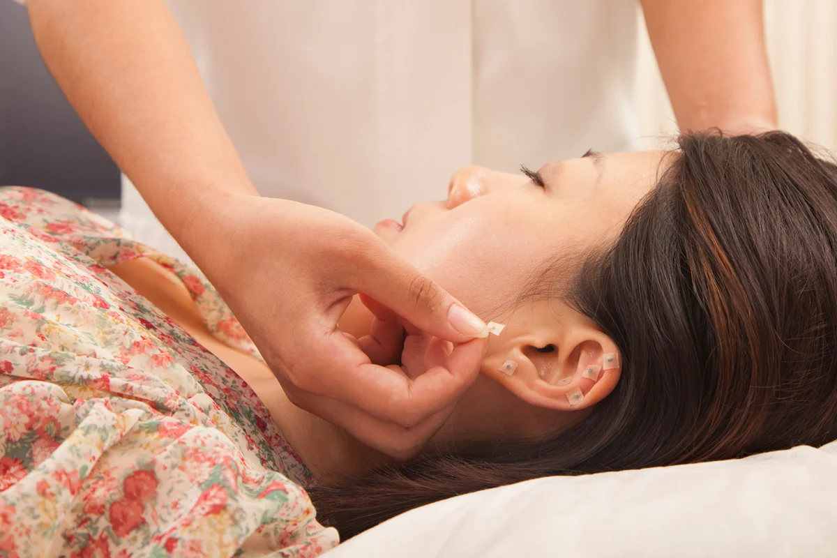 Chinese doctor using acupuncture on patient