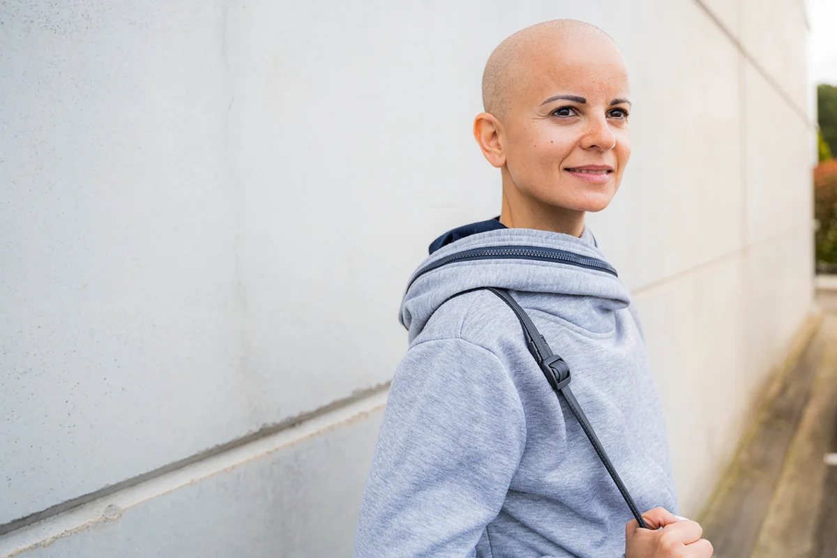 Portrait of a woman with alopecia