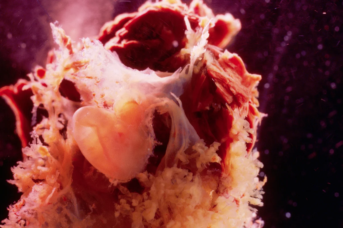 Human Embryo With Placenta