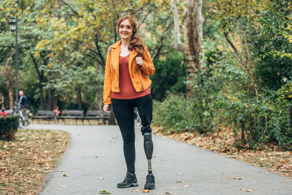 Young woman with prosthetic leg standing at park