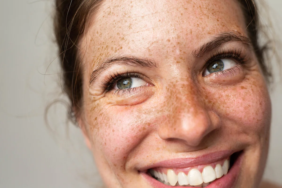 portrait of a woman with freckles