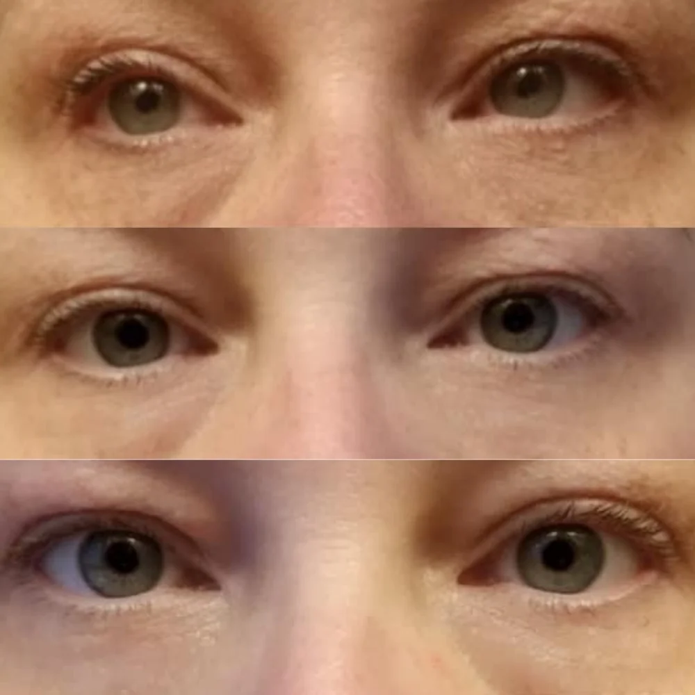LilyAna Retinol results