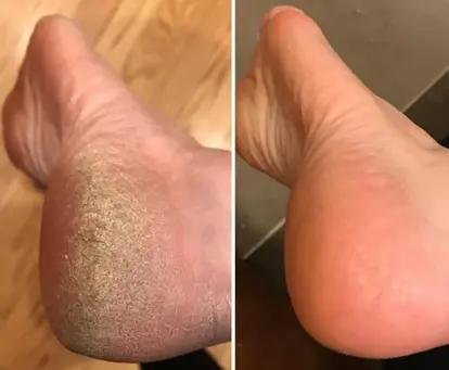 Love Lori Before & After