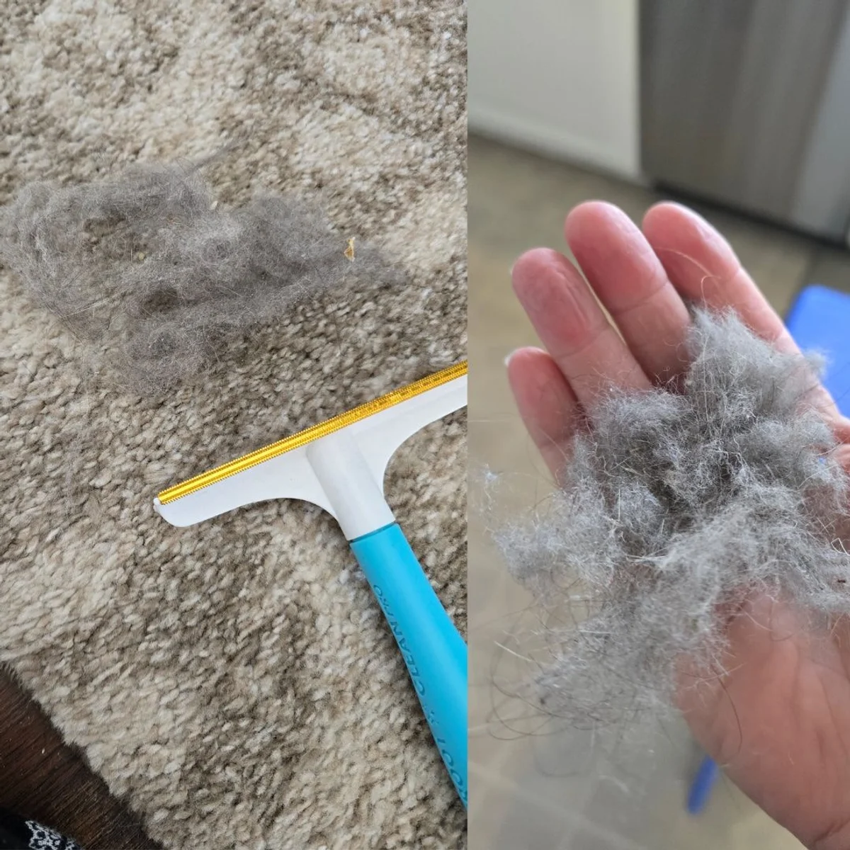 Hair removed by Uproot Pro from Kristen G. 