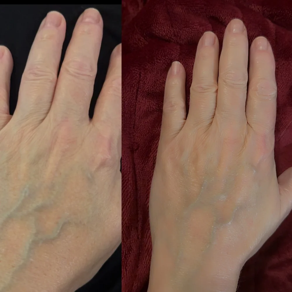 avha hand cream before/after