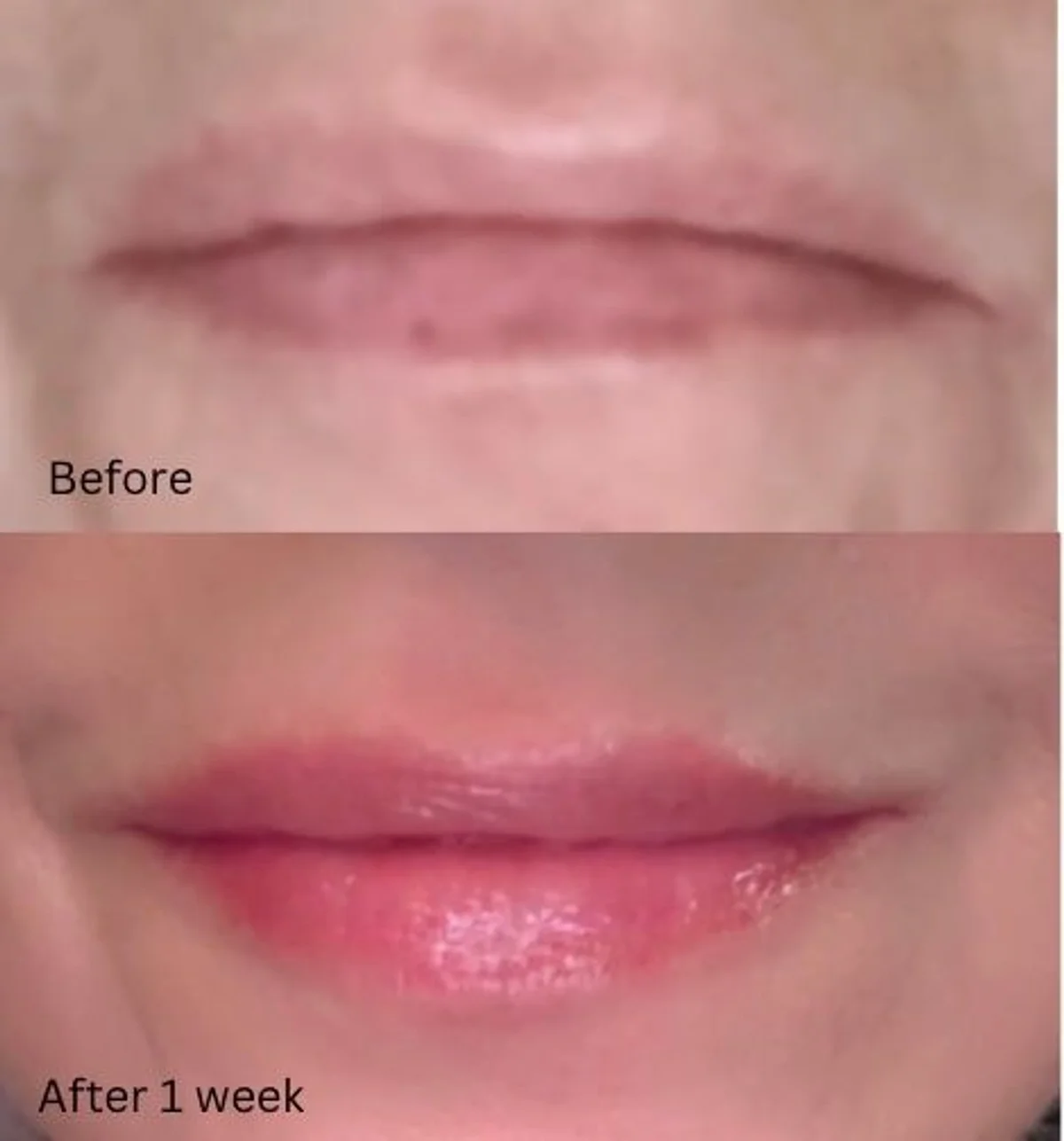 Wonderskin lip oil before and after - Terri N. 