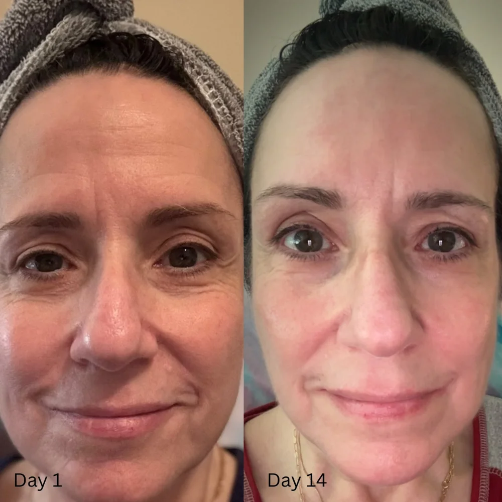 Eye masks before/after Terri N. 