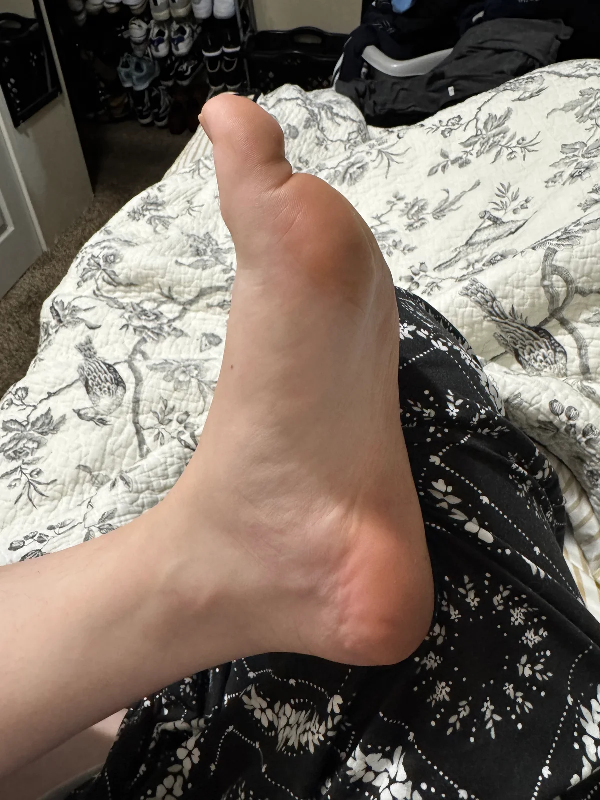 Foot after using foot scrubbing kit