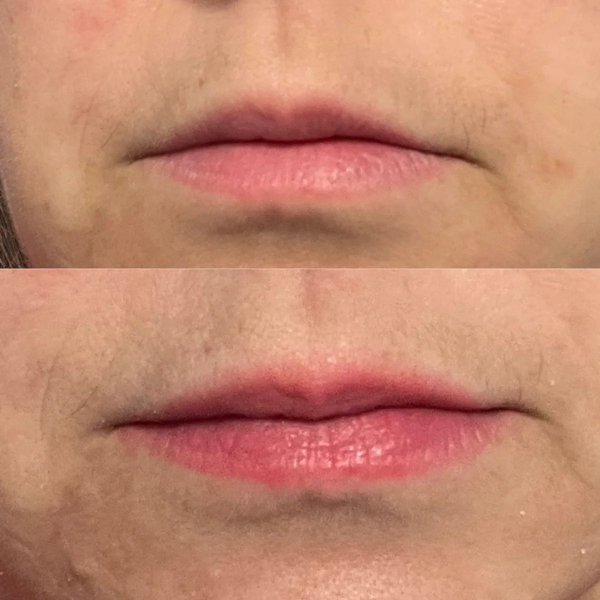 Brooklyn Botany peppermint lip scrub before/after on Jessica H. 