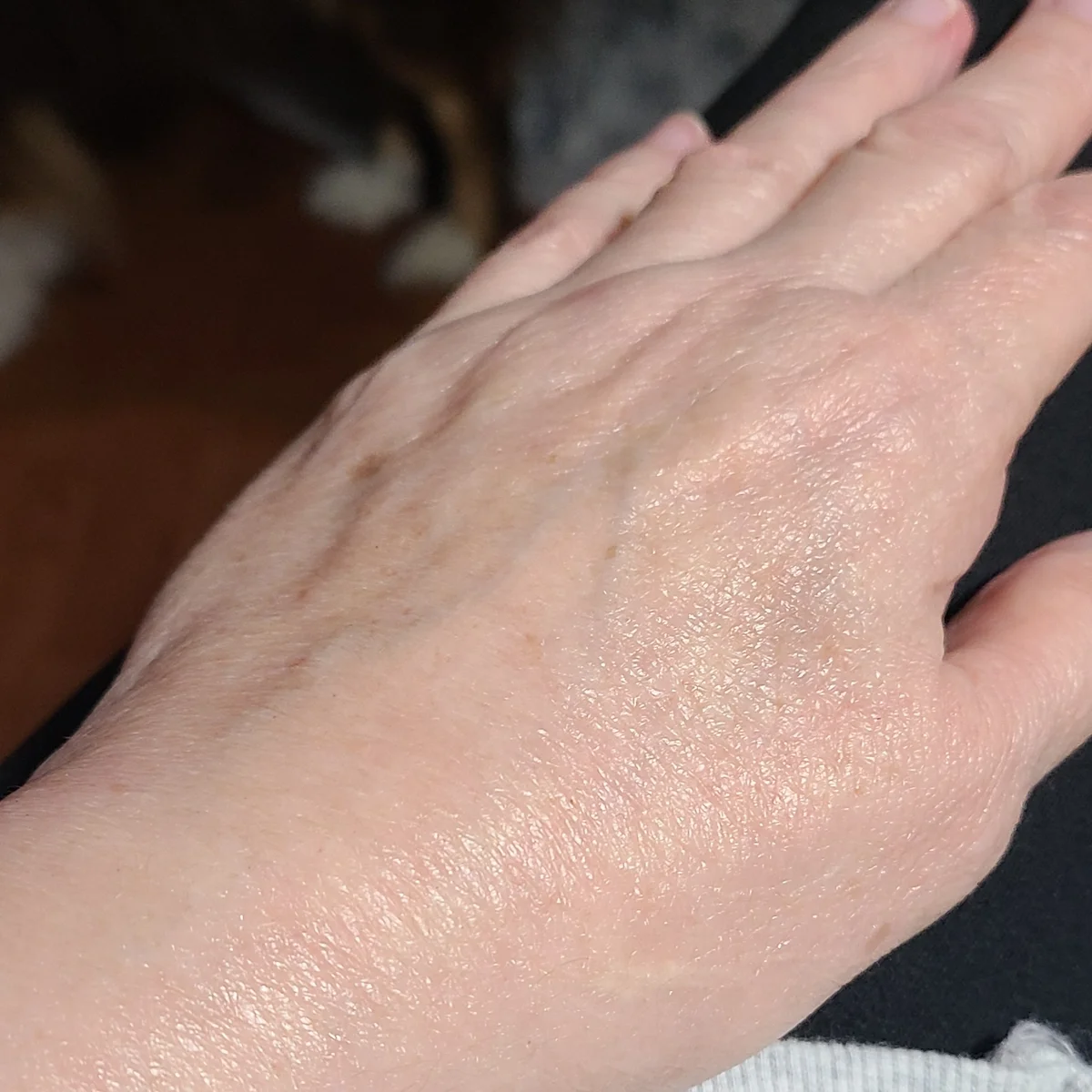 retinol cream effects