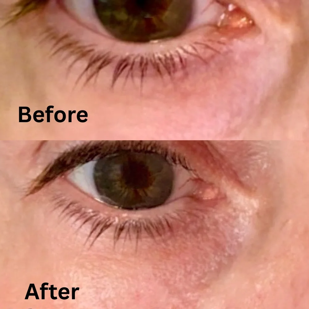 Snail mucin eye cream before & after